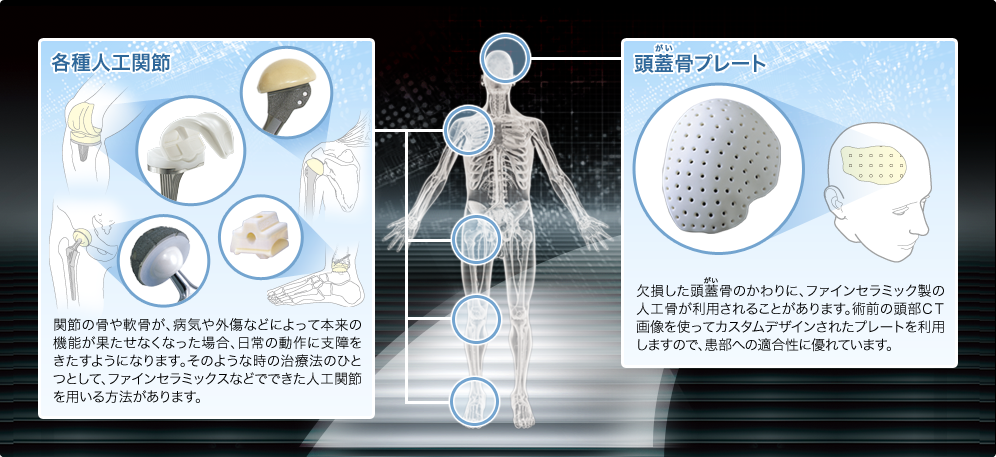 図：ファインセラミックスが体の中に