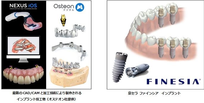 ニュースルーム用画像（オステオン）.jpg