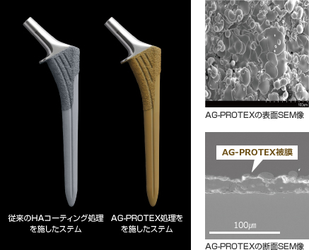 図：従来のHAコーティング処理を施したステム,AG-PROTEX処理を施したステム,AG-PROTEXの表面SEM像,AG-PROTEX被膜 AG-PROTEXの断面SEM像