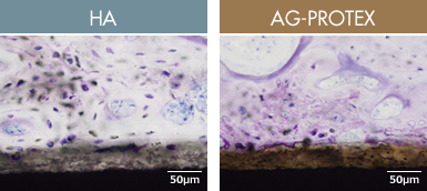 図：HAとAG-PROTEXの埋入後4週の組織観察像