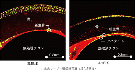 写真：無処理とAHFIXの共焦点レーザー顕微鏡写真（埋入3週後）