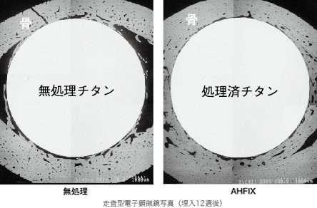 写真：無処理とAHFIXの走査型電子顕微鏡写真（埋入12週後）