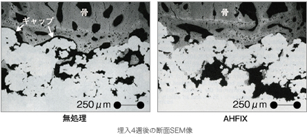 写真：無処理とAHFIXの埋入4週後の断面SEM像