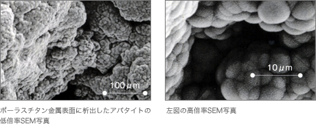 写真：ポーラスチタン金属表面に析出したアパタイトの低倍率SEM写真と左図の高倍率SEM写真