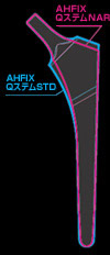 図：AHFIX QステムNAR／QステムSTD