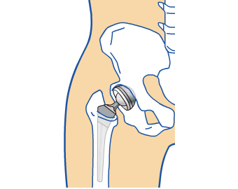 図：股関節のしくみ