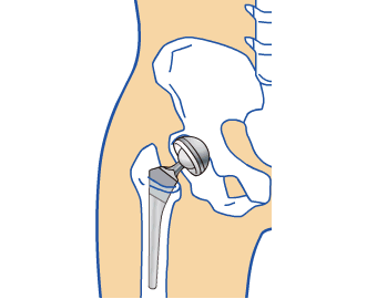 図：股関節のしくみ