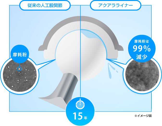 図：15年経過した従来の人工股関節とアクアラライナー