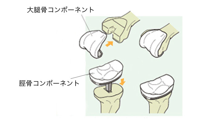 イメージ図