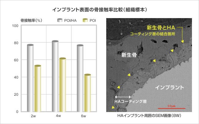 イメージ：インプラント表面の骨接触率比較（組織標本）