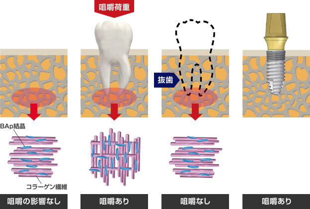 イメージ：咀嚼状態に応じた配向性変化の模式図