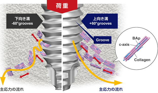 イメージ：インプラントにおける配向性の概念図