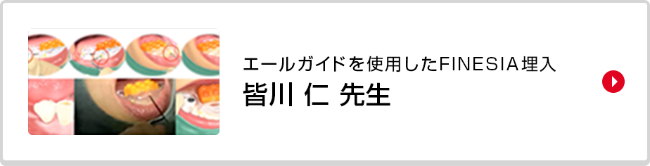 「エールガイドを使用したFINESIA埋入」皆川 仁先生