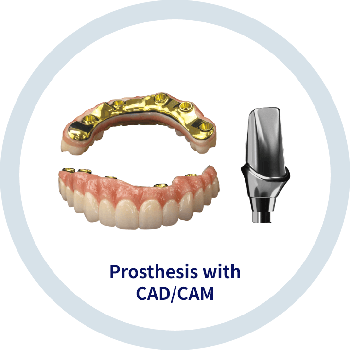Prosthesis with CAD/CAM