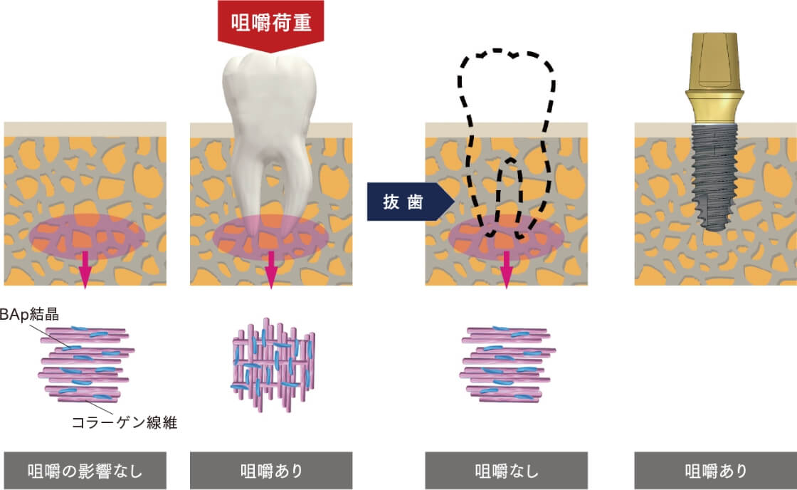 咀嚼状態に応じた配向性変化の模式図