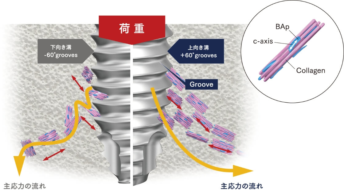 インプラントにおける配向性の概念図