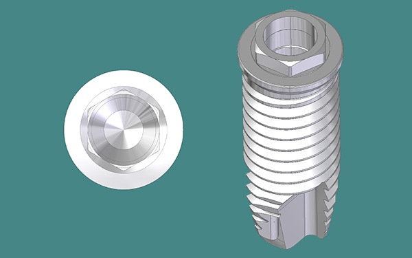 インプラントコネクション部　エクスターナル・ヘキサゴン・コネクション